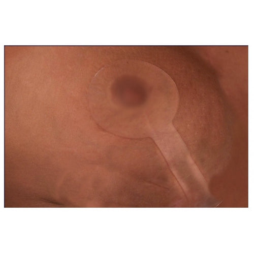Scar Fx Lollipop Mastopexy Breast Silicone Sheet