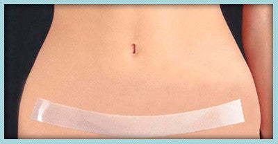 Epi-Derm Silicone Gel Strip