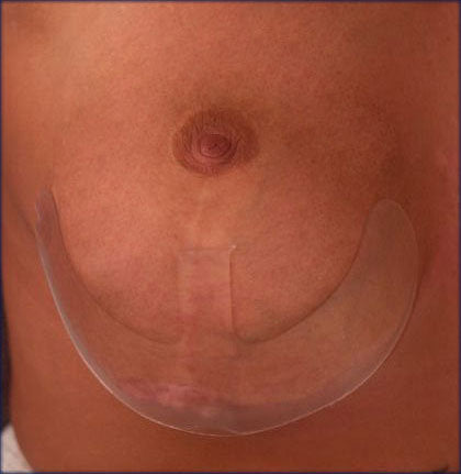 Scar FX Silicone Sheet Breast Piece